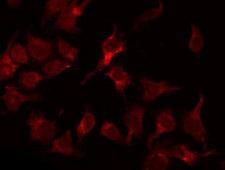 PSMD2 Antibody - Staining COLO205 cells by IF/ICC. The samples were fixed with PFA and permeabilized in 0.1% Triton X-100, then blocked in 10% serum for 45 min at 25°C. The primary antibody was diluted at 1:200 and incubated with the sample for 1 hour at 37°C. An Alexa Fluor 594 conjugated goat anti-rabbit IgG (H+L) Ab, diluted at 1/600, was used as the secondary antibody.