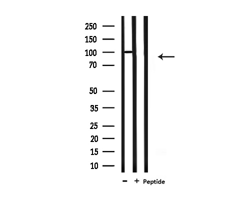 PSMD2 Antibody - Western blot analysis of extracts of 293 cells using PSMD2 antibody.