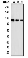 PSMD2 Antibody - Western blot analysis of PSMD2 expression in Jurkat (A); A431 (B); NIH3T3 (C) whole cell lysates.