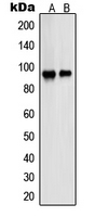 PSMD2 Antibody - Western blot analysis of PSMD2 expression in A431 (A); HeLa (B) whole cell lysates.