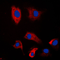 PSMD2 Antibody - Immunofluorescent analysis of PSMD2 staining in HeLa cells. Formalin-fixed cells were permeabilized with 0.1% Triton X-100 in TBS for 5-10 minutes and blocked with 3% BSA-PBS for 30 minutes at room temperature. Cells were probed with the primary antibody in 3% BSA-PBS and incubated overnight at 4 C in a humidified chamber. Cells were washed with PBST and incubated with a DyLight 594-conjugated secondary antibody (red) in PBS at room temperature in the dark. DAPI was used to stain the cell nuclei (blue).