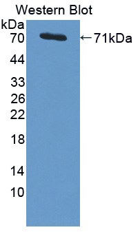 PSMD4 / RPN10 Antibody - Western blot of PSMD4 / RPN10 antibody.