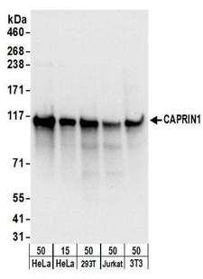 PSMD4 / RPN10 Antibody - Detection of human and mouse CAPRIN1 by western blot. Samples: Whole cell lysate from HeLa (15 and 50 µg), HEK293T (50µg), Jurkat (50µg), and mouse NIH 3T3 (50µg) cells. Antibodies: Affinity purified rabbit anti-CAPRIN1 antibody used for WB at 0.1 µg/ml. Detection: Chemiluminescence with an exposure time of 3 seconds.