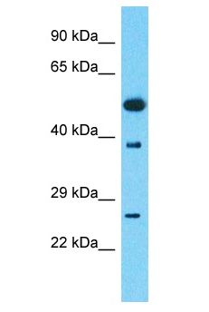 PSMD4 / RPN10 Antibody - PSMD4 antibody Western Blot of Thymus Tumor. Antibody dilution: 1 ug/ml.  This image was taken for the unconjugated form of this product. Other forms have not been tested.