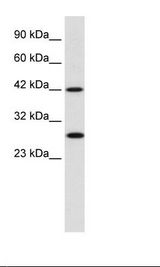 PSMD4 / RPN10 Antibody - Raji Cell Lysate.  This image was taken for the unconjugated form of this product. Other forms have not been tested.