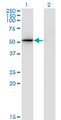 PSMD4 / RPN10 Antibody - Western Blot analysis of PSMD4 expression in transfected 293T cell line by PSMD4 monoclonal antibody (M01), clone 3C9.Lane 1: PSMD4 transfected lysate(40.7 KDa).Lane 2: Non-transfected lysate.