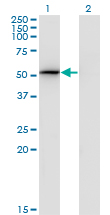 PSMD4 / RPN10 Antibody - Western Blot analysis of PSMD4 expression in transfected 293T cell line by PSMD4 monoclonal antibody (M01), clone 3C9.Lane 1: PSMD4 transfected lysate(40.7 KDa).Lane 2: Non-transfected lysate.