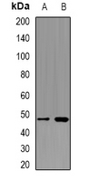 PSMD4 / RPN10 Antibody - Western blot analysis of PSMD4 expression in K562 (A); Jurkat (B) whole cell lysates.