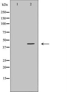 PSMD4 / RPN10 Antibody - Western blot analysis of K562 cells using PSMD4 antibody. The lane on the left is treated with the antigen-specific peptide.