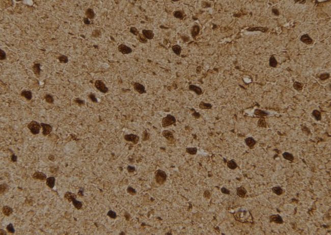 PSMD4 / RPN10 Antibody - 1:100 staining rat brain tissue by IHC-P. The sample was formaldehyde fixed and a heat mediated antigen retrieval step in citrate buffer was performed. The sample was then blocked and incubated with the antibody for 1.5 hours at 22°C. An HRP conjugated goat anti-rabbit antibody was used as the secondary.
