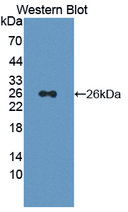 PSMD5 Antibody - Western blot of PSMD5 antibody.