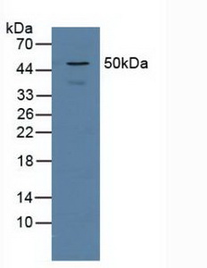 PSMD5 Antibody - Western Blot; Sample: Human Jurkat Cells.