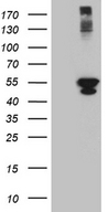 PSMD5 Antibody - HEK293T cells were transfected with the pCMV6-ENTRY control. (Left lane) or pCMV6-ENTRY PSMD5. (Right lane) cDNA for 48 hrs and lysed