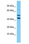 PSMD5 Antibody - PSMD5 antibody Western Blot of OVCAR-3. Antibody dilution: 1 ug/ml.  This image was taken for the unconjugated form of this product. Other forms have not been tested.