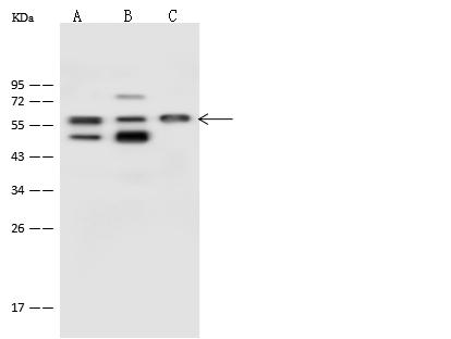 PSMD5 Antibody - Anti-PSMD5 rabbit polyclonal antibody at 1:500 dilution. Lane A: A431 Whole Cell Lysate. Lane B: Hela Whole Cell Lysate. Lane C: HepG2 Whole Cell Lysate. Lysates/proteins at 30 ug per lane. Secondary: Goat Anti-Rabbit IgG (H+L)/HRP at 1/10000 dilution. Developed using the ECL technique. Performed under reducing conditions. Predicted band size: 56 kDa. Observed band size: 57 kDa.