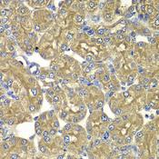 PSMD5 Antibody - Immunohistochemistry of paraffin-embedded Rat kidney using PSMD5 Polyclonal Antibody at dilution of 1:100 (40x lens).