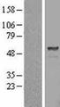 PSMD5 Protein - Western validation with an anti-DDK antibody * L: Control HEK293 lysate R: Over-expression lysate