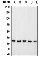 PSMD6 Antibody - Western blot analysis of PSMD6 expression in HeLa (A); Jurkat (B); HEK293T (C); SP2/0 (D); PC12 (E) whole cell lysates.