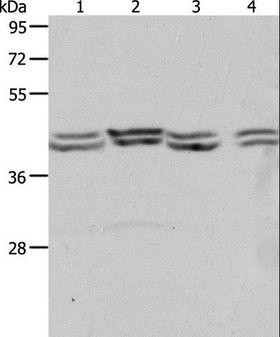 PSMD6 Antibody - Western blot analysis of HeLa, 293T, NIH/3T3 and Jurkat cell, using PSMD6 Polyclonal Antibody at dilution of 1:650.