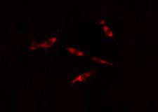PSMD6 Antibody - Staining HeLa cells by IF/ICC. The samples were fixed with PFA and permeabilized in 0.1% Triton X-100, then blocked in 10% serum for 45 min at 25°C. The primary antibody was diluted at 1:200 and incubated with the sample for 1 hour at 37°C. An Alexa Fluor 594 conjugated goat anti-rabbit IgG (H+L) antibody, diluted at 1/600, was used as secondary antibody.