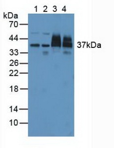PSMD7 / MOV34 Antibody - Western Blot; Sample: Lane1: Human Hela Cells; Lane2: Human 293T Cells; Lane3: Human Liver Tissue; Lane4: Human Lung Tissue.