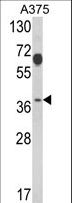 PSMD7 / MOV34 Antibody - Western blot of PSMD7 Antibody in A375 cell line lysates (35 ug/lane). PSMD7 (arrow) was detected using the purified antibody.