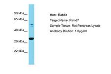 PSMD7 / MOV34 Antibody -  This image was taken for the unconjugated form of this product. Other forms have not been tested.