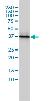 PSMD7 / MOV34 Antibody - PSMD7 monoclonal antibody (M01), clone 2G5 Western Blot analysis of PSMD7 expression in Jurkat.