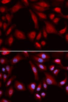 PSMD7 / MOV34 Antibody - Immunofluorescence analysis of U2OS cells.