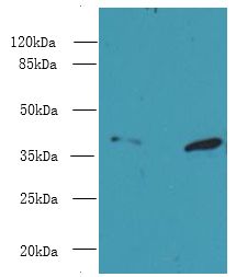 PSMD7 / MOV34 Antibody - Western blot. All lanes: PSMD7 antibody at 8 ug/ml. Lane 1: HeLa whole cell lysate. Lane 2: K562 whole cell lysate. Secondary antibody: Goat polyclonal to Rabbit IgG at 1:10000 dilution. Predicted band size: 37 kDa. Observed band size: 37 kDa.