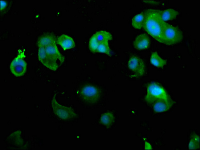 PSMD7 / MOV34 Antibody - Immunofluorescence staining of MCF-7 cells with PSMD7 Antibody at 1:266, counter-stained with DAPI. The cells were fixed in 4% formaldehyde, permeabilized using 0.2% Triton X-100 and blocked in 10% normal Goat Serum. The cells were then incubated with the antibody overnight at 4°C. The secondary antibody was Alexa Fluor 488-congugated AffiniPure Goat Anti-Rabbit IgG(H+L).