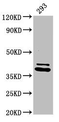 PSMD7 / MOV34 Antibody - Western Blot Positive WB detected in: 293 whole cell lysate All lanes: PSMD7 antibody at 3.2µg/ml Secondary Goat polyclonal to rabbit IgG at 1/50000 dilution Predicted band size: 38 kDa Observed band size: 38 kDa