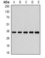 PSMD7 / MOV34 Antibody - Western blot analysis of PSMD7 expression in MCF7 (A); A549 (B); K562 (C); mouse heart (D); mouse testis (E) whole cell lysates.
