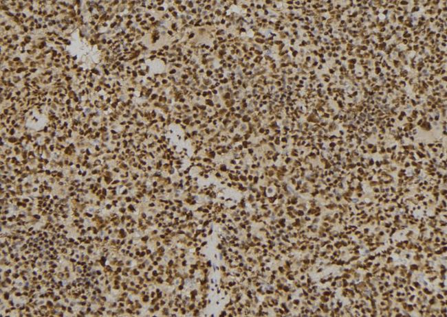 PSMD7 / MOV34 Antibody - 1:100 staining mouse spleen tissue by IHC-P. The sample was formaldehyde fixed and a heat mediated antigen retrieval step in citrate buffer was performed. The sample was then blocked and incubated with the antibody for 1.5 hours at 22°C. An HRP conjugated goat anti-rabbit antibody was used as the secondary.