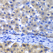 PSMD8 / RPN12 Antibody - Immunohistochemistry of paraffin-embedded human liver injury tissue.