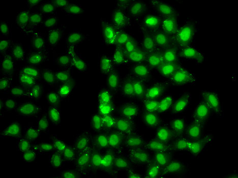 PSMD8 / RPN12 Antibody - Immunofluorescence analysis of U20S cells.