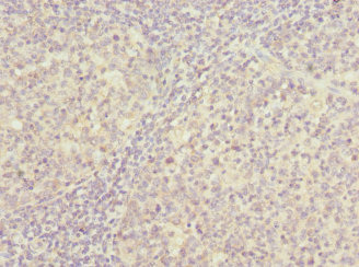 PSMD8 / RPN12 Antibody - Immunohistochemistry of paraffin-embedded human tonsil tissue at dilution 1:100
