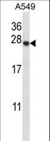 PSMD9 / 26S Proteasome Antibody - PSMD9 Antibody western blot of A549 cell line lysates (35 ug/lane). The PSMD9 antibody detected the PSMD9 protein (arrow).