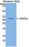 PSMD9 / 26S Proteasome Antibody - Western blot of recombinant PSMD9 / 26S Proteasome.