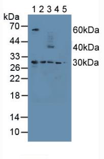 PSMD9 / 26S Proteasome Antibody - Western Blot; Sample: Lane1: Human Liver Tissue; Lane2: Mouse Spleen Tissue; Lane3: Mouse Heart Tissue; Lane4: Human A549 Cells; Lane5: Mouse Placenta Tissue.