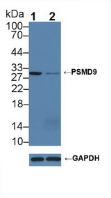 PSMD9 / 26S Proteasome Antibody - Knockout Varification: Lane 1: Wild-type A549 cell lysate; Lane 2: PSMD9 knockout A549 cell lysate; Predicted MW: 24,22,13kd Observed MW: 30kd Primary Ab: 5µg/ml Rabbit Anti-Human PSMD9 Antibody Second Ab: 0.2µg/mL HRP-Linked Caprine Anti-Rabbit IgG Polyclonal Antibody