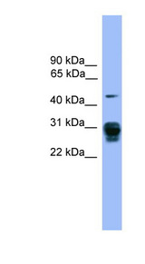 PSMD9 / 26S Proteasome Antibody - PSMD9 / 26S Proteasome antibody Western blot of 293T cell lysate. This image was taken for the unconjugated form of this product. Other forms have not been tested.