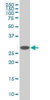 PSMD9 / 26S Proteasome Antibody - PSMD9 monoclonal antibody (M01), clone 3A4 Western Blot analysis of PSMD9 expression in HepG2.
