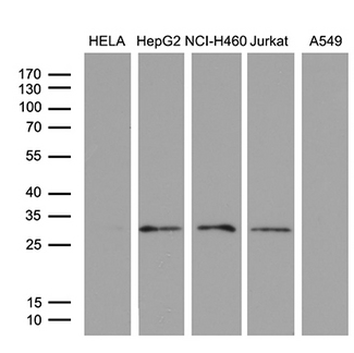 PSMD9 / 26S Proteasome Antibody - Western blot analysis of extracts. (35ug) from 5 different cell lines by using anti-PSMD9 monoclonal antibody. (1:500)