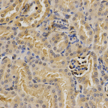 PSMD9 / 26S Proteasome Antibody - Immunohistochemistry of paraffin-embedded mouse kidney using PSMD9 antibody at dilution of 1:200 (x400 lens).