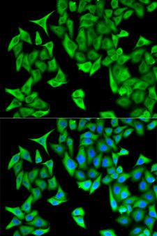 PSMD9 / 26S Proteasome Antibody - Immunofluorescence analysis of HeLa cell using PSMD9 antibody. Blue: DAPI for nuclear staining.