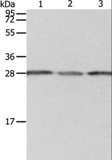 PSMD9 / 26S Proteasome Antibody - Western blot analysis of A549 cell, human liver cancer and fetal kidney tissue, using PSMD9 Polyclonal Antibody at dilution of 1:800.