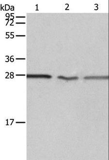 PSMD9 / 26S Proteasome Antibody - Western blot analysis of Jurkat, A549 cell and Human fetal kidney tissue, using PSMD9 Polyclonal Antibody at dilution of 1:750.