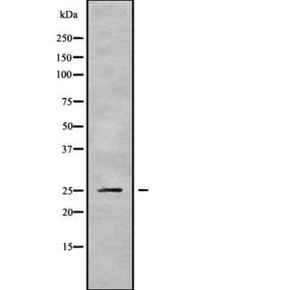 PSMD9 / 26S Proteasome Antibody - Western blot analysis of PSMD9 using HepG2 whole cells lysates