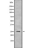 PSMD9 / 26S Proteasome Antibody - Western blot analysis of PSMD9 using HepG2 whole cells lysates